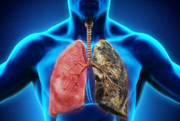 Upper Respiratory Infections