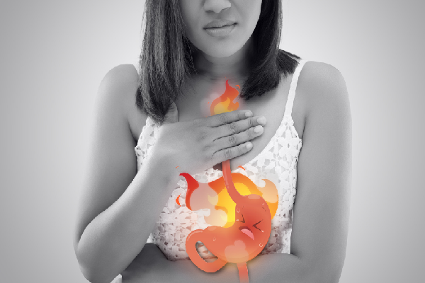 Acid Reflux